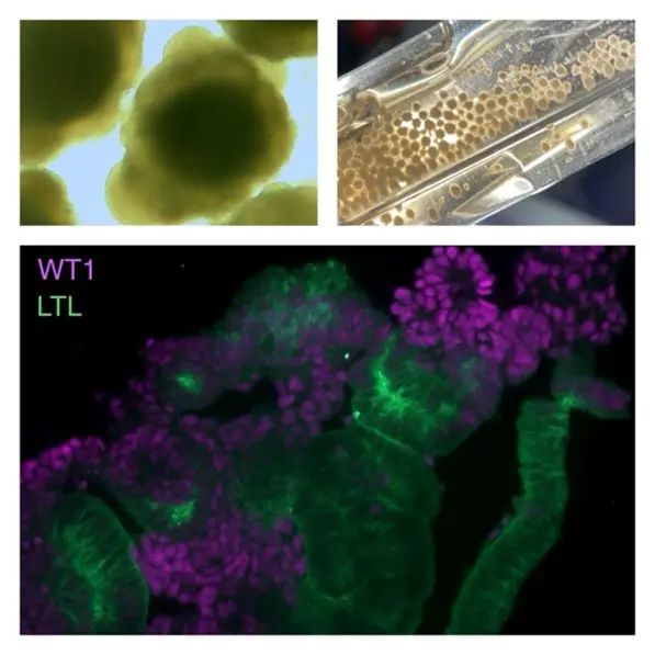 Nierenorganoide aus iPSC, gewachsen im CERO 3D Bioreaktor