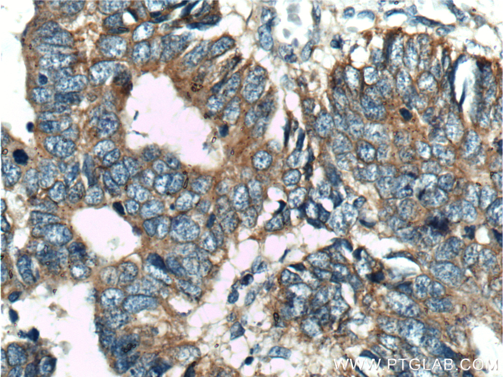 USP11 Polyclonal antibody