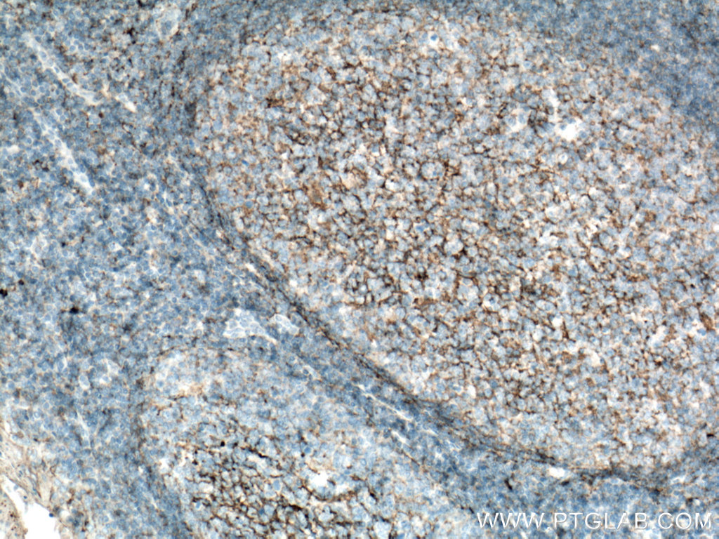 CD82 Polyclonal antibody