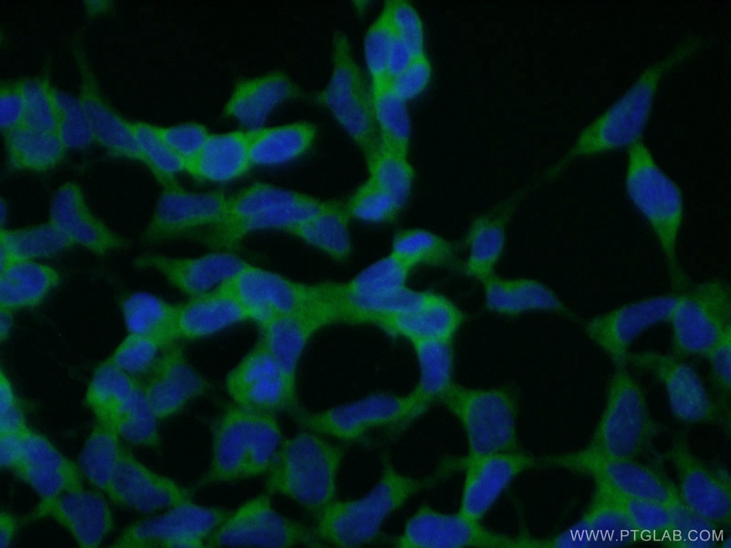 CNOT2 Polyclonal antibody