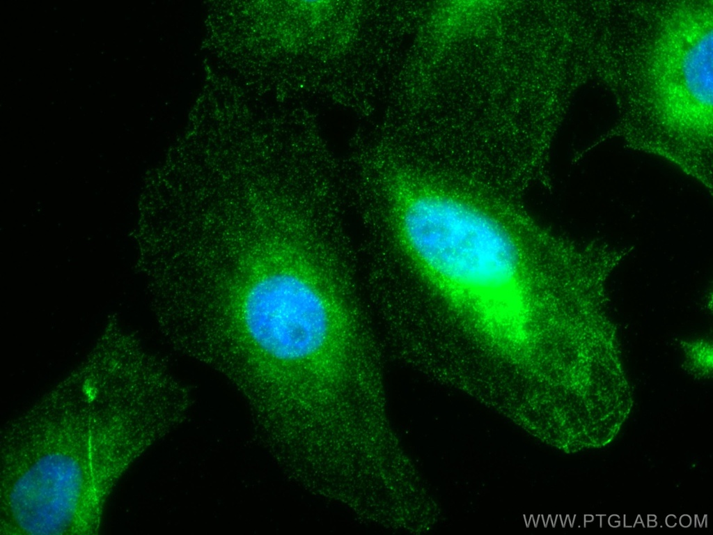 Stanniocalcin 2 Polyclonal antibody