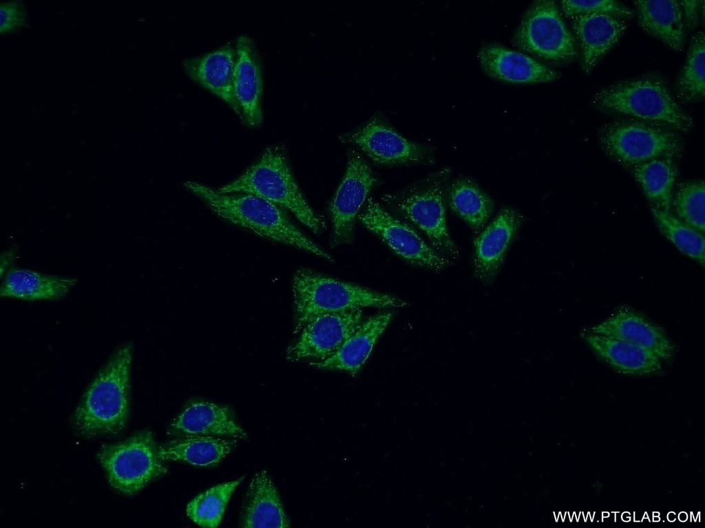 Cathepsin H Polyclonal antibody