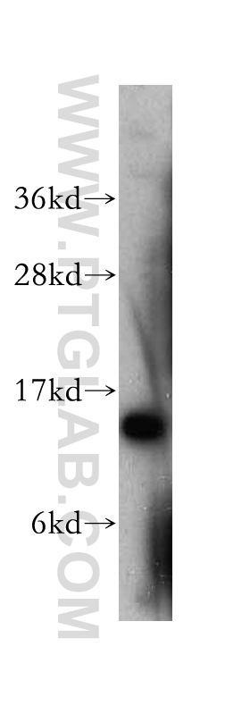 SMA4 Polyclonal antibody
