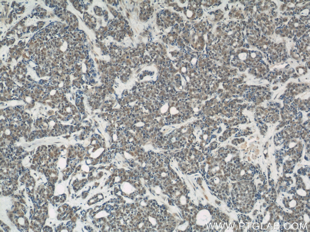 NUDT21 Polyclonal antibody