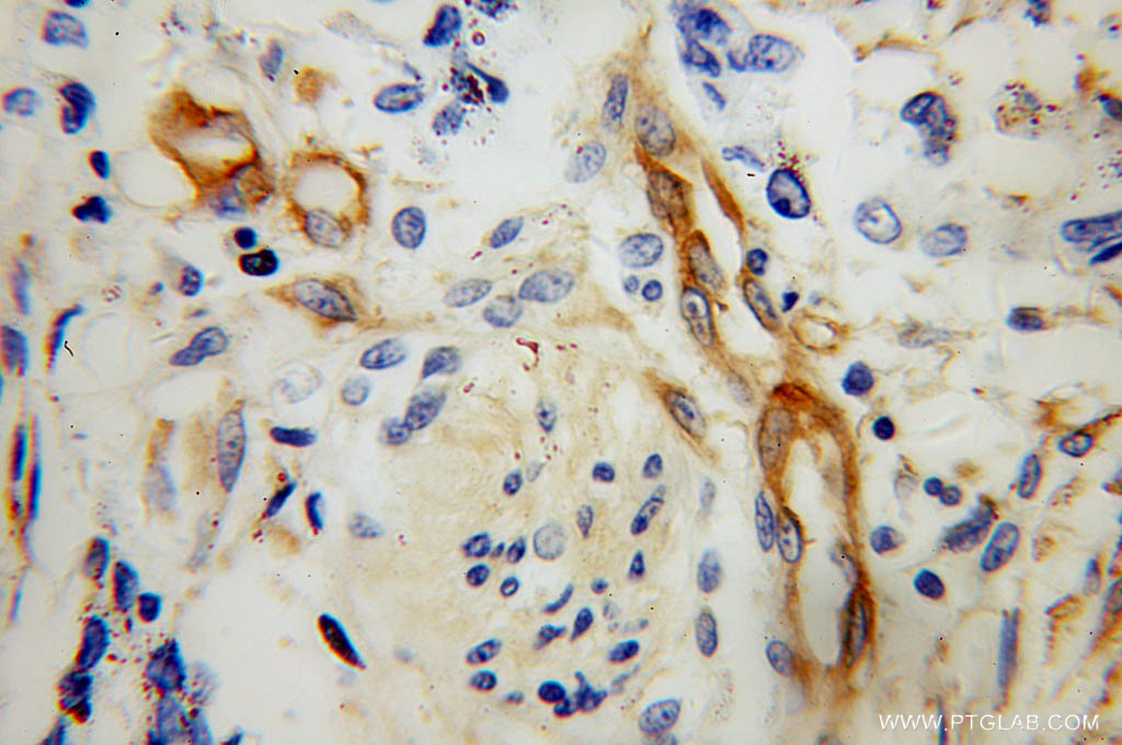 MYL12B Polyclonal antibody