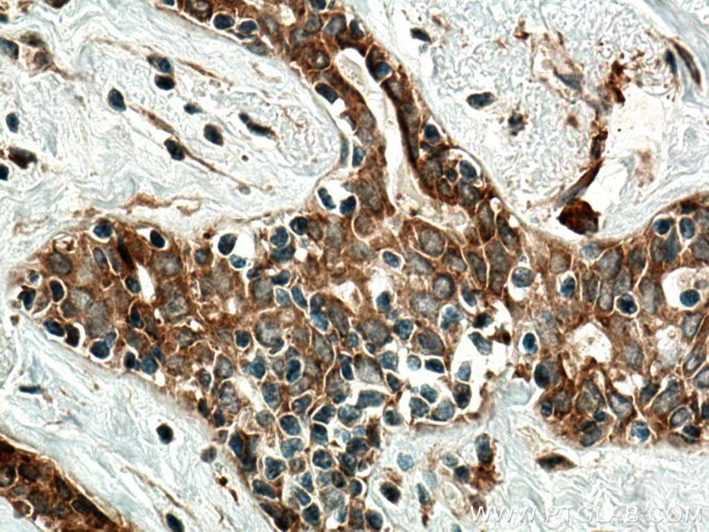 RARA Polyclonal antibody
