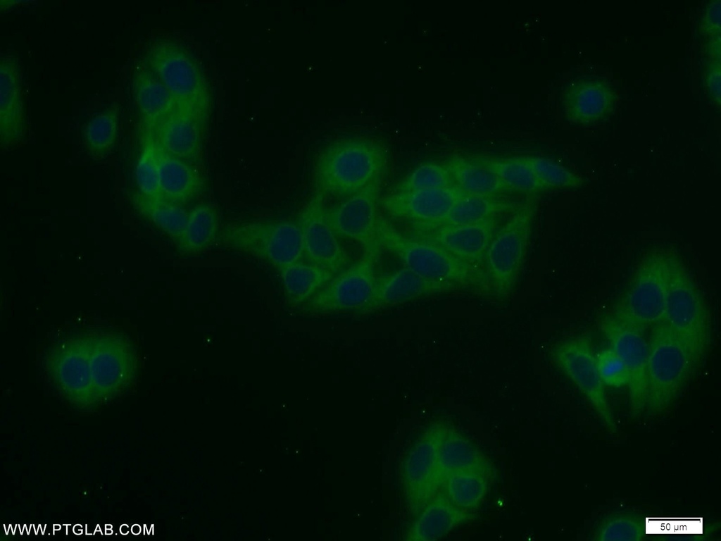TRAIP Polyclonal antibody