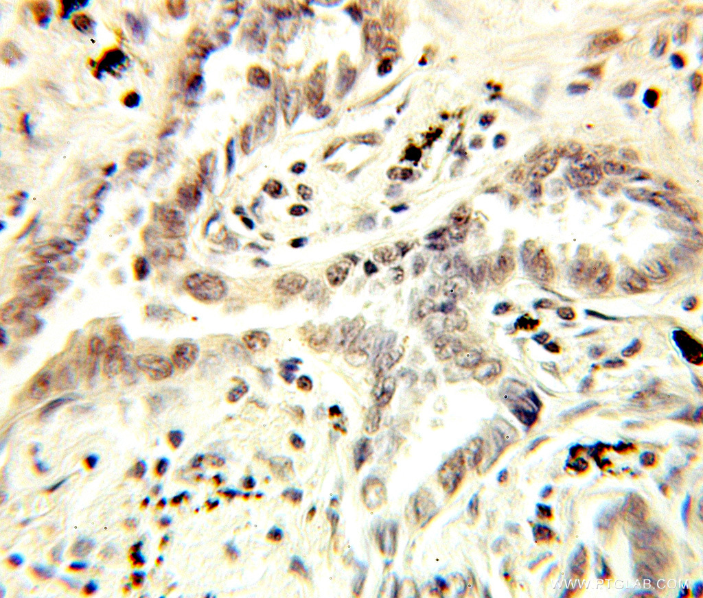 NCBP1 Polyclonal antibody