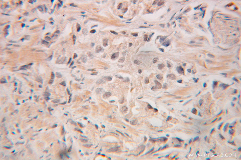 GRWD1 Polyclonal antibody