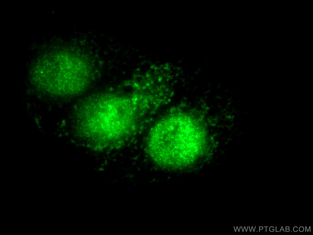 P21 Polyclonal antibody