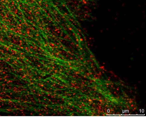 MAPRE2 Polyclonal antibody