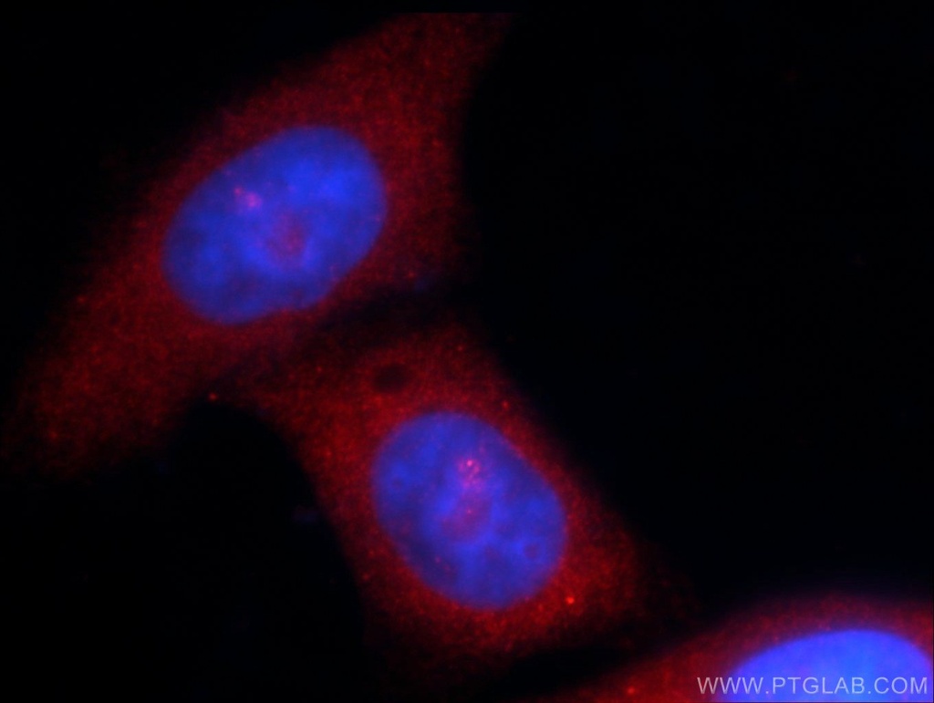 MOV10 Polyclonal antibody