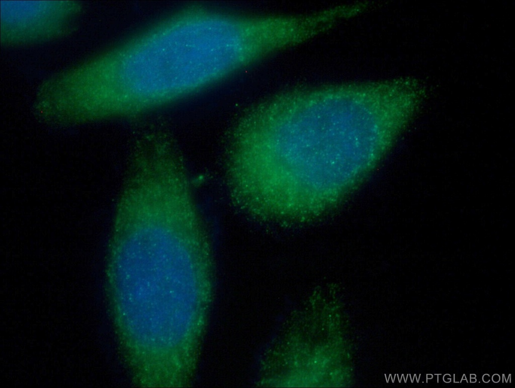 MMP2 Polyclonal antibody