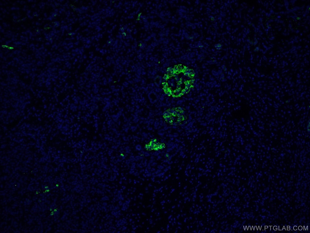 MMP7 Polyclonal antibody