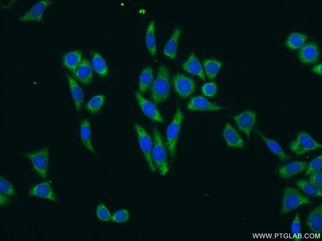 TTK Polyclonal antibody