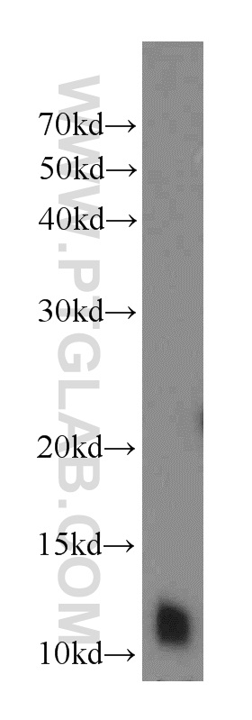 DNAL4 Polyclonal antibody