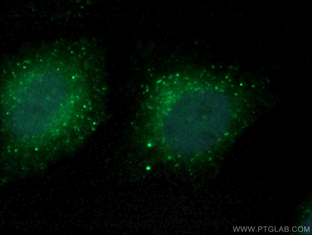 COMMD5 Polyclonal antibody