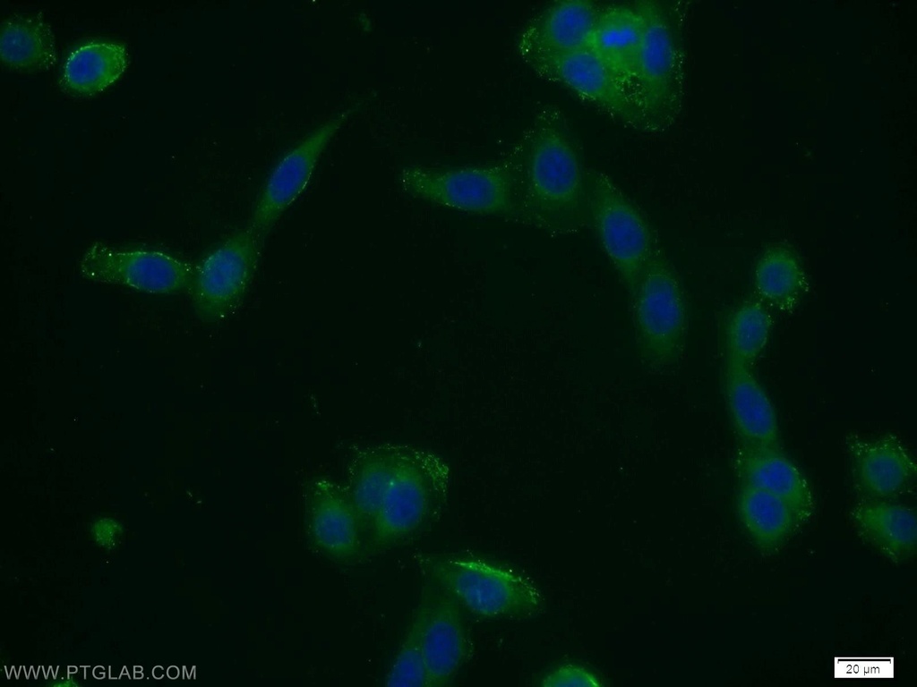 CFLAR/FLIP Polyclonal antibody