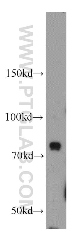 BCAS3 Polyclonal antibody