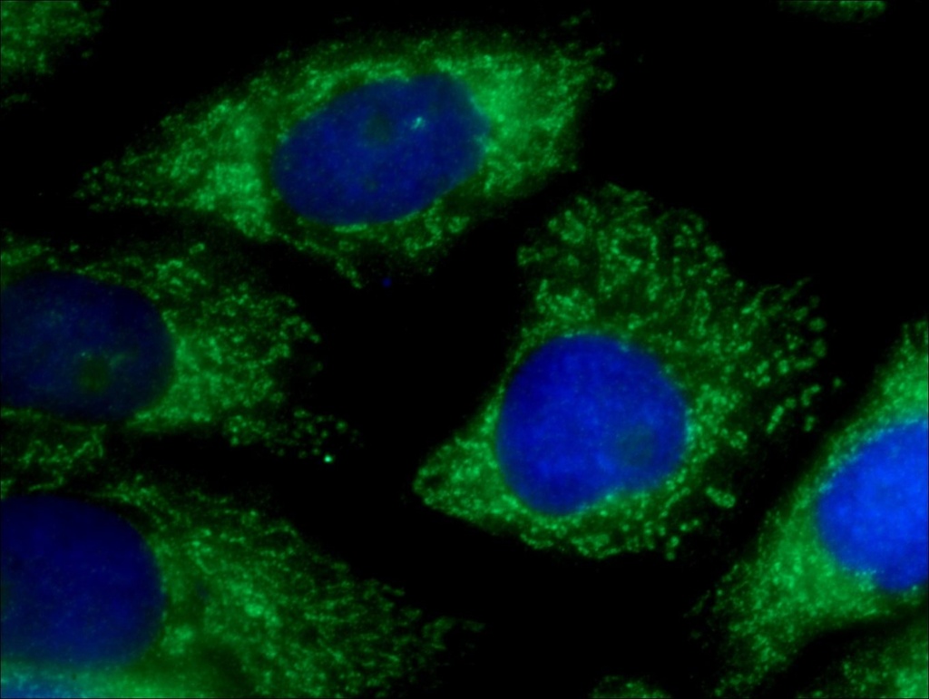 ICT1 Polyclonal antibody