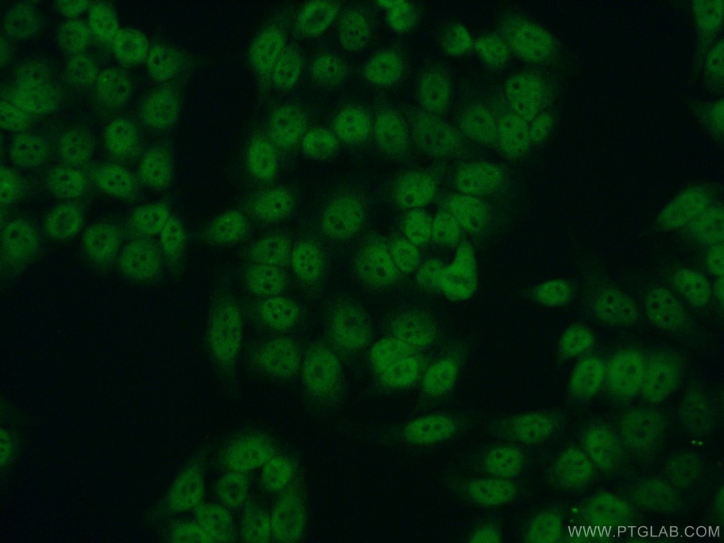 RPA2 Polyclonal antibody