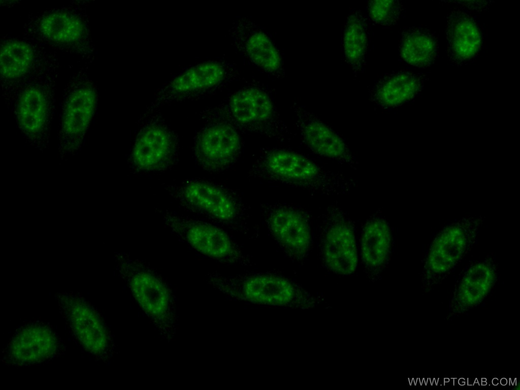 BCAS2 Polyclonal antibody