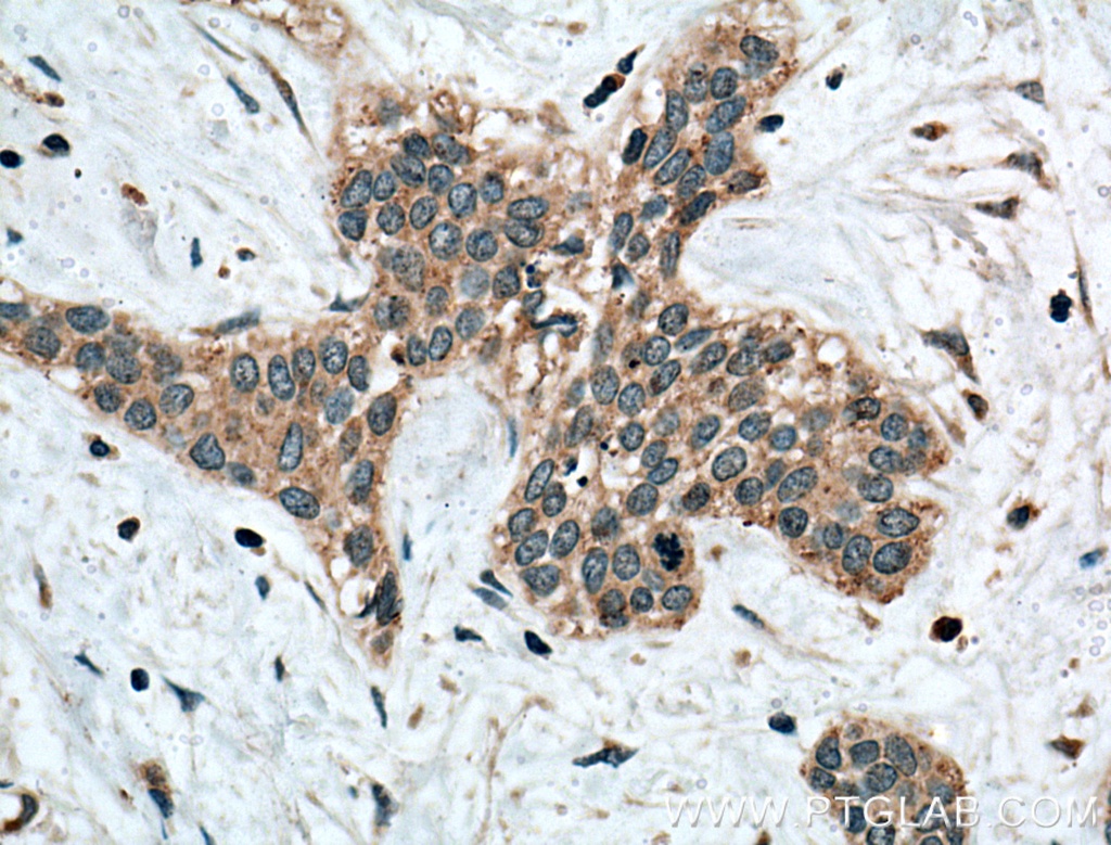 Calpain 3 Polyclonal antibody