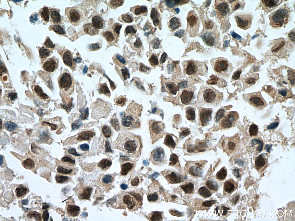 GATA3 Polyclonal antibody