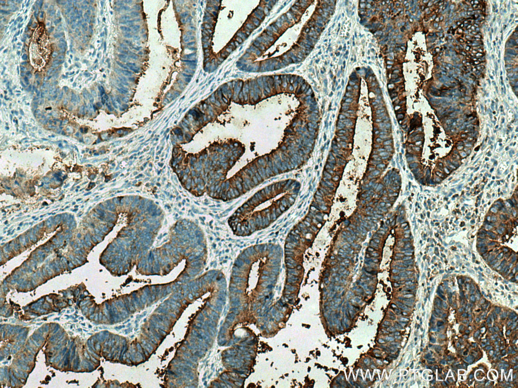 CEA Polyclonal antibody