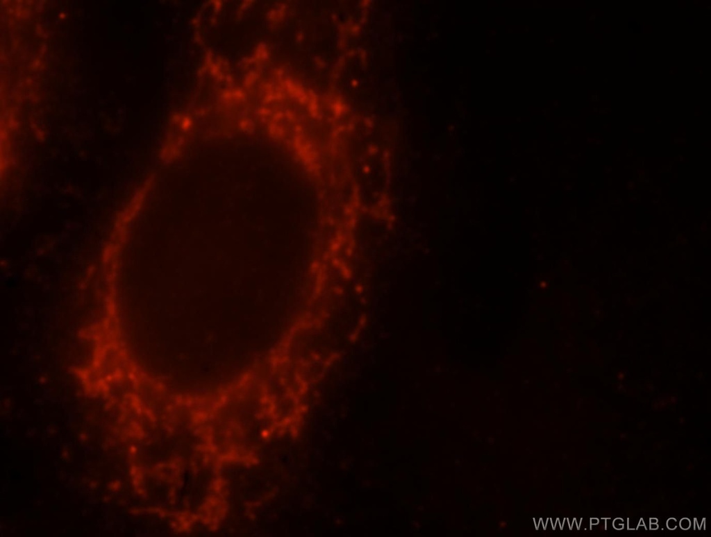YY1AP1 Polyclonal antibody