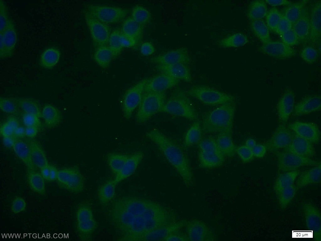 SMAD1 Polyclonal antibody