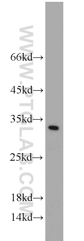 Synaptogyrin 1 Polyclonal antibody