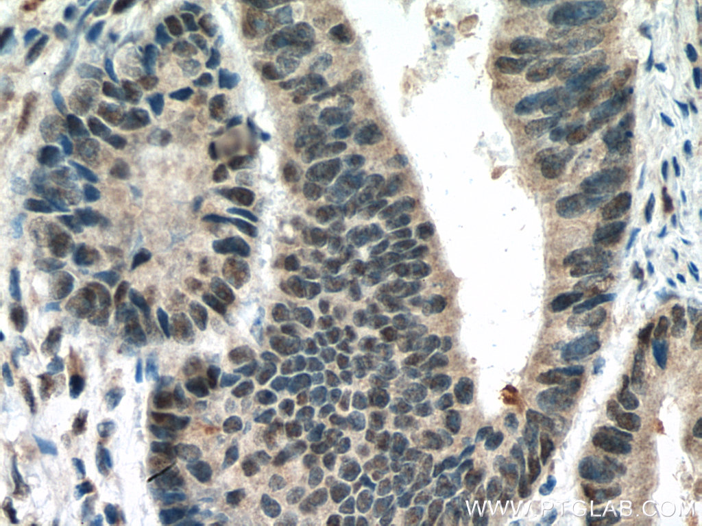 TORC1/CRTC1 Polyclonal antibody