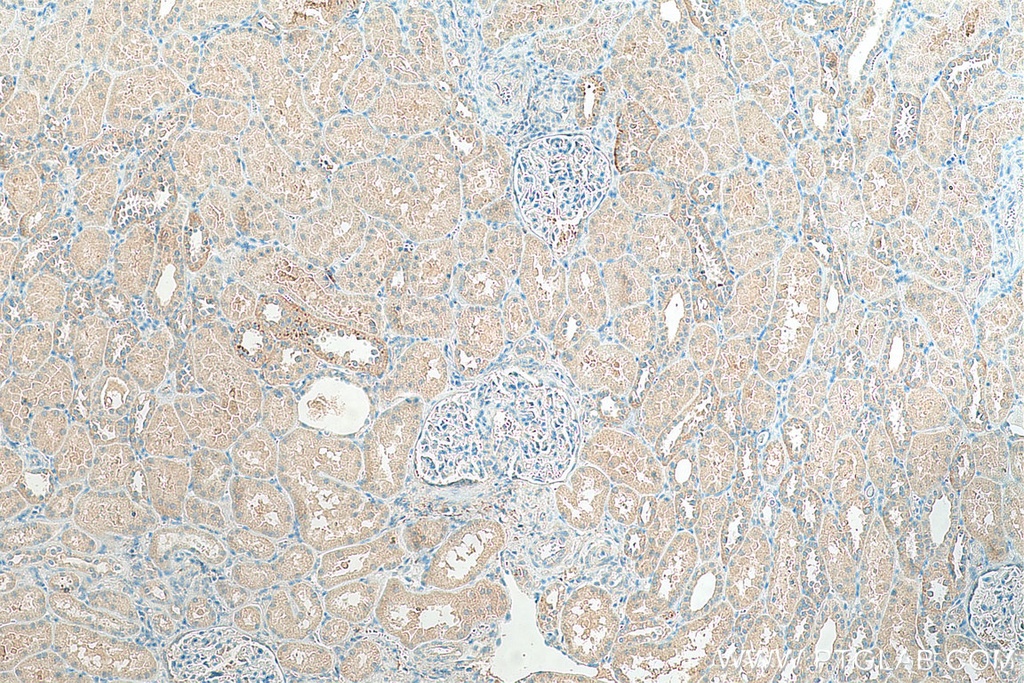 SLC43A1 Polyclonal antibody
