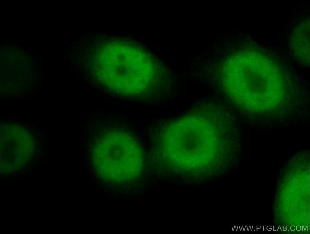 RAN Polyclonal antibody