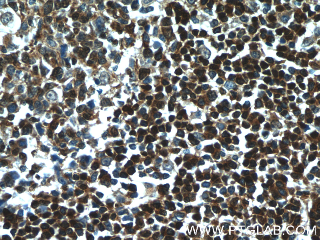 TCL1A Polyclonal antibody