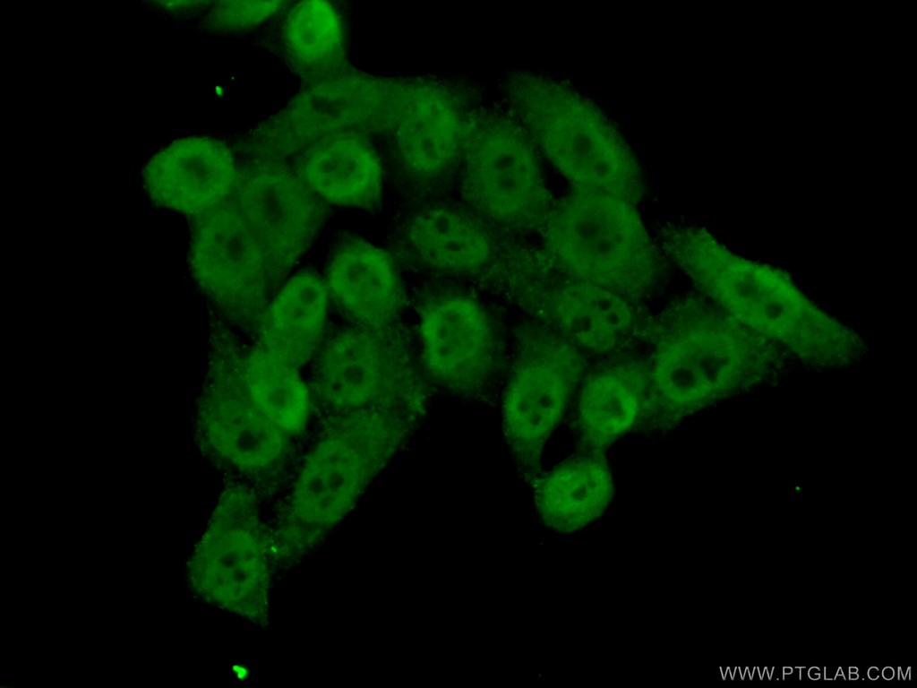 BRD8 Polyclonal antibody