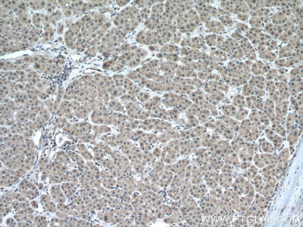 CHMP2A Polyclonal antibody
