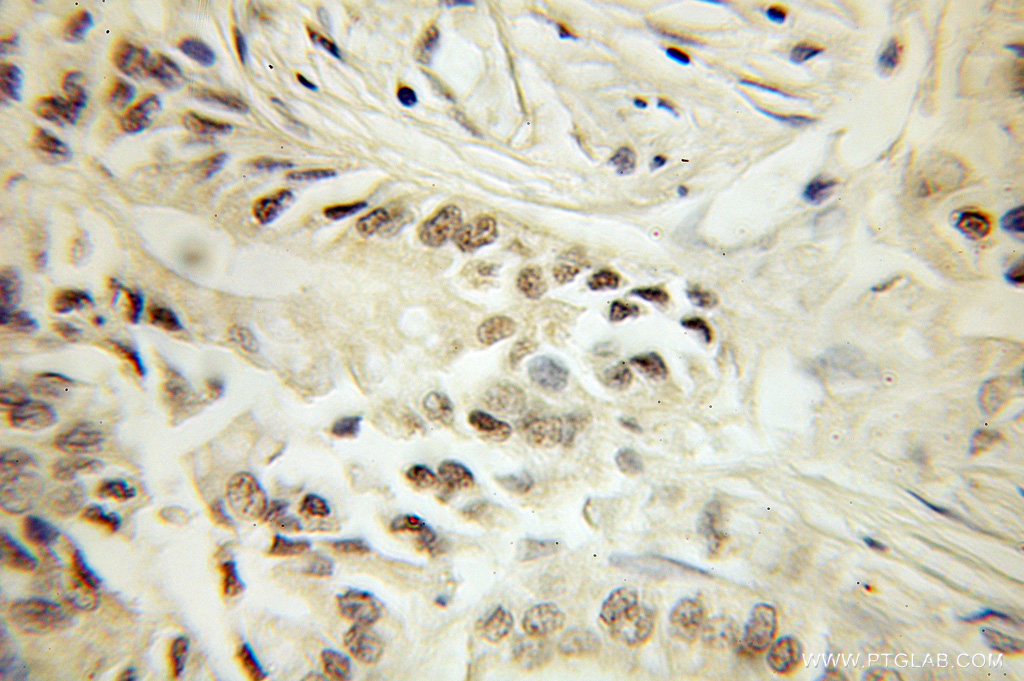 SF3B4 Polyclonal antibody