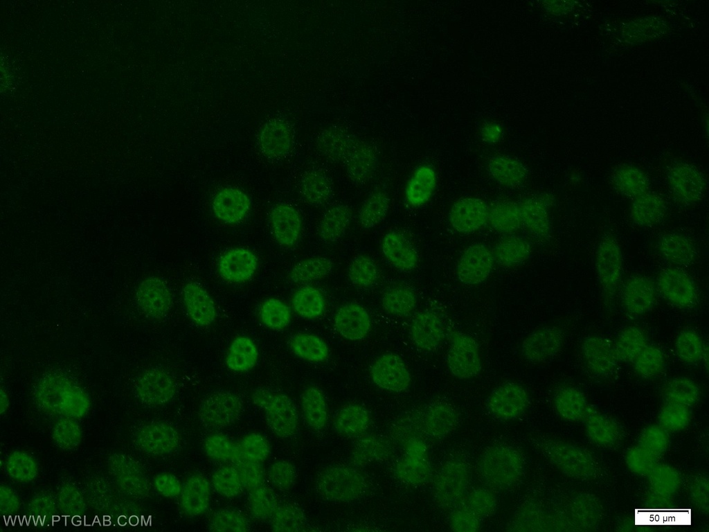 JUNB Polyclonal antibody