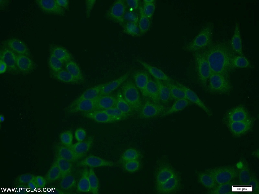 STARD5 Polyclonal antibody