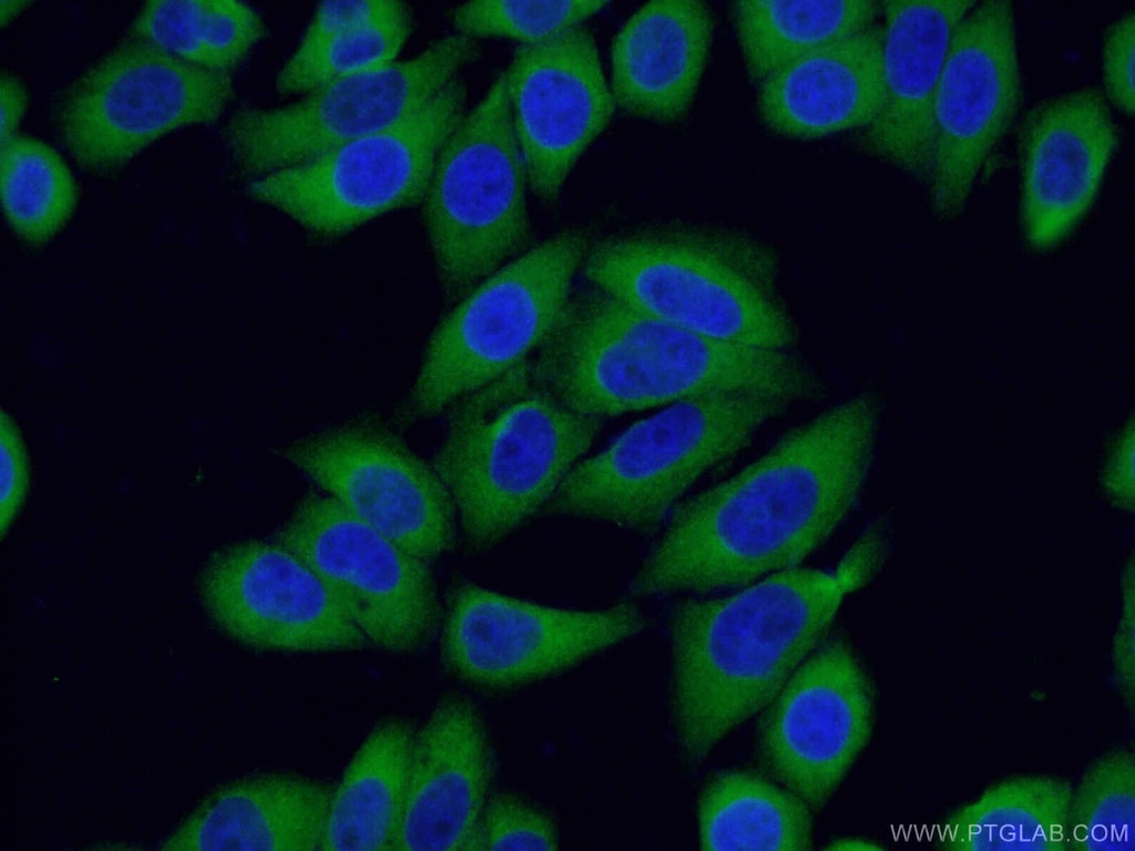S100A14 Polyclonal antibody
