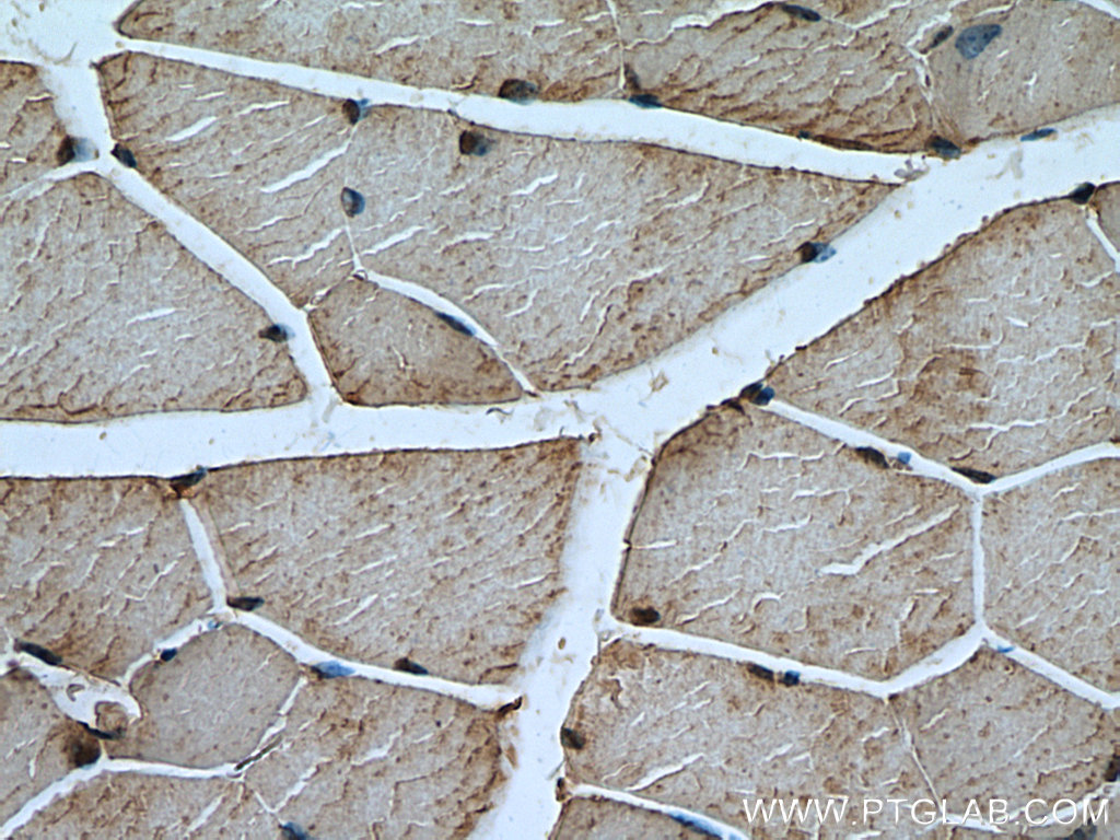 Calpain 3 Polyclonal antibody