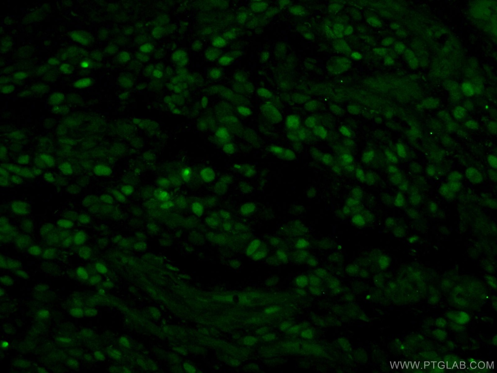 MCM2 Polyclonal antibody
