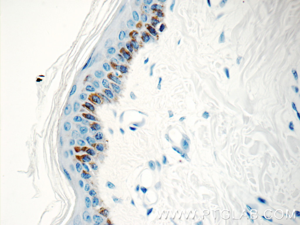 Kallikrein 5 Polyclonal antibody