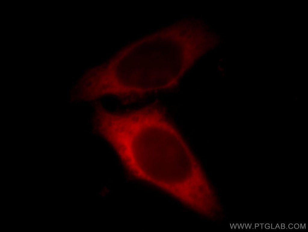 LASP1 Polyclonal antibody