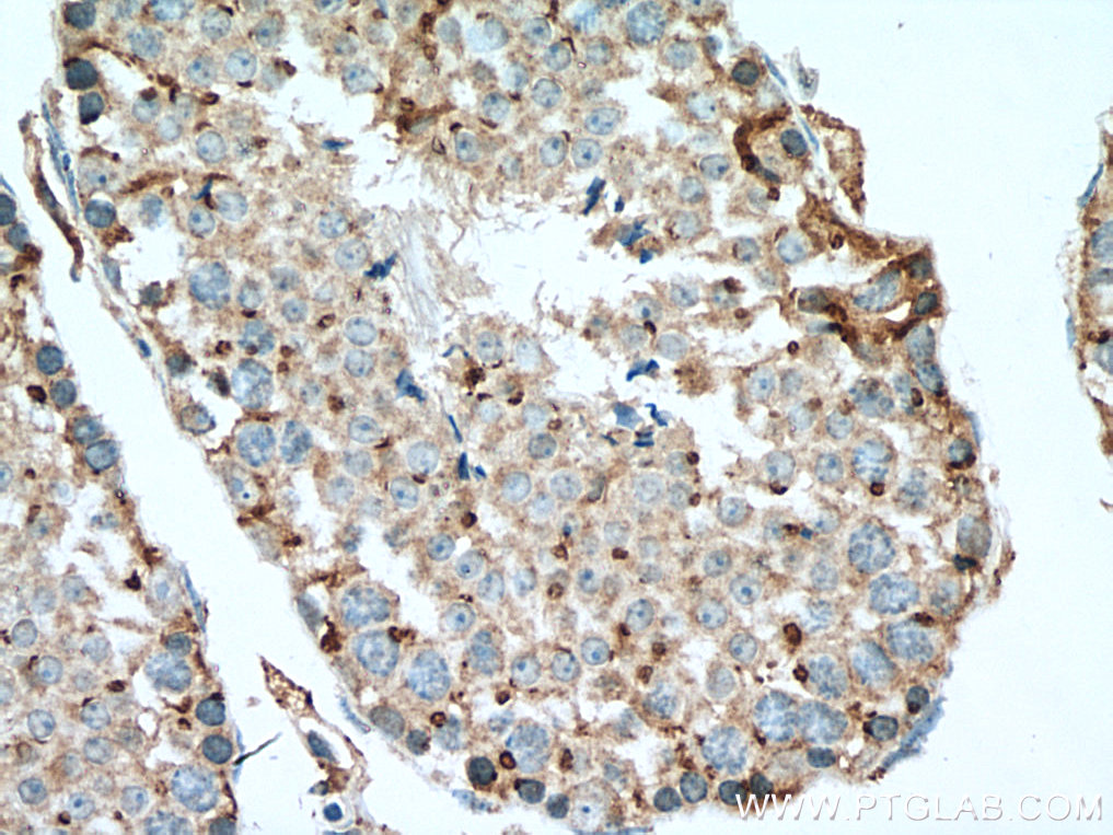 SDF4 Polyclonal antibody