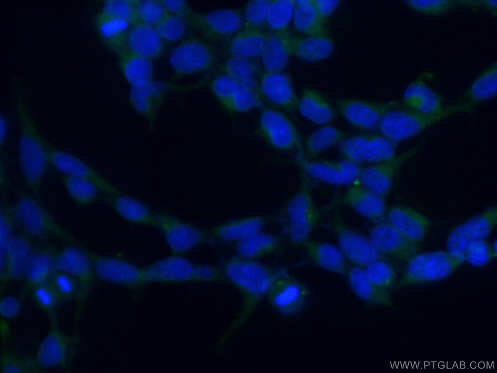 PCMT1 Polyclonal antibody