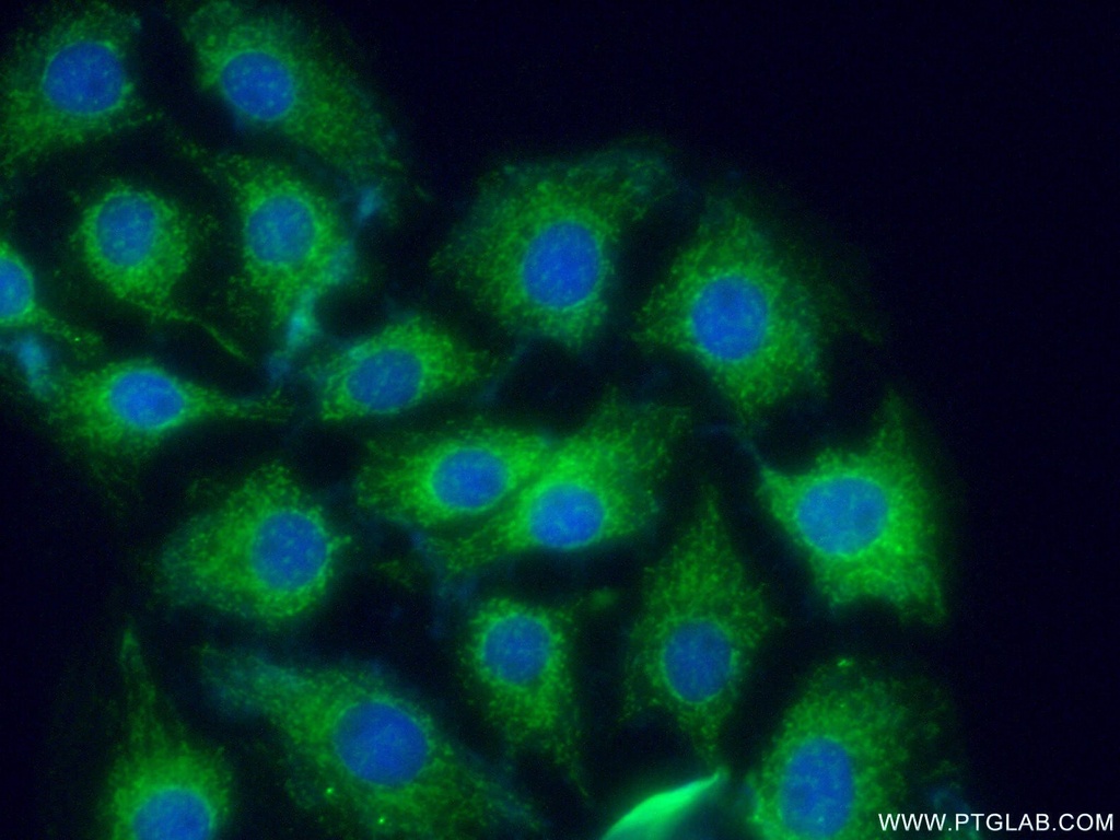 CRMP5 Polyclonal antibody