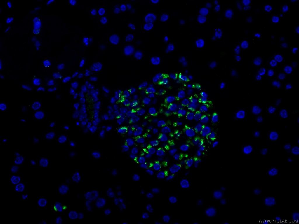 Chromogranin A Polyclonal antibody